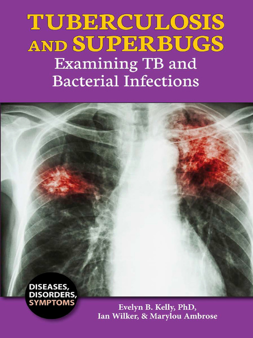 Title details for Tuberculosis and Superbugs by Evelyn B. Kelly, PhD - Available